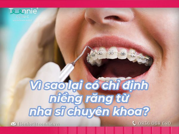 Vì sao lại có chỉ định niềng răng từ nha sĩ chuyên khoa?