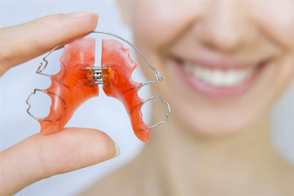 Hàm duy trì là một khí cụ hỗ trợ được sử dụng sau khi tháo niềng răng