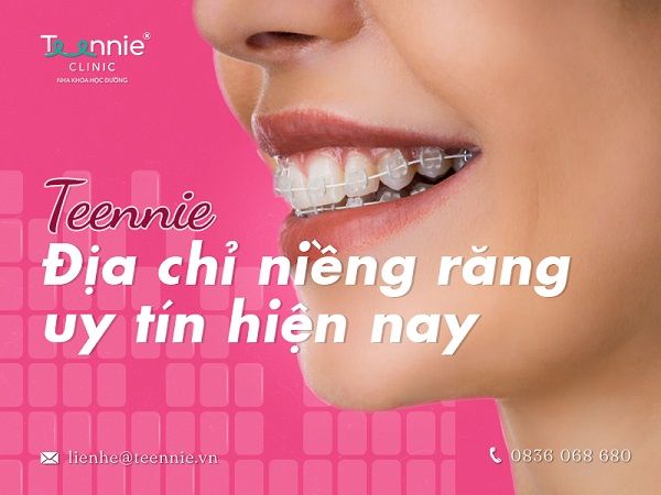Giải đáp từ chuyên gia Teennie: Tại sao phải niềng răng chỉnh nha?