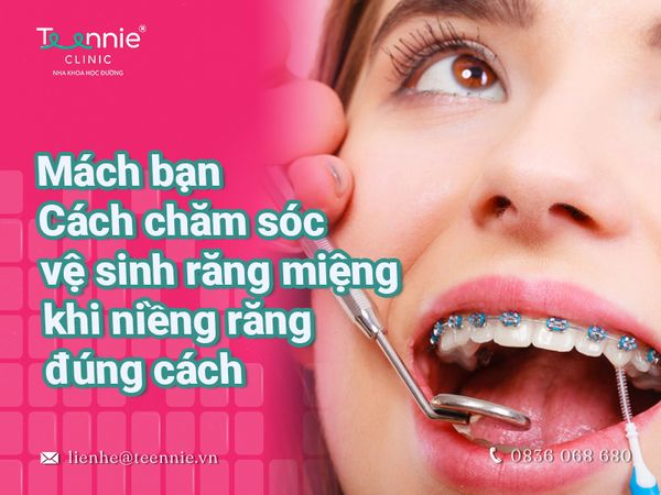 Gợi ý cách đánh răng khi niềng răng thật đúng cách