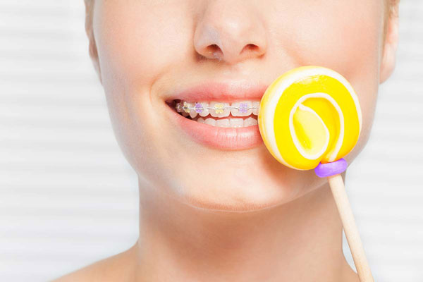 Niềng răng thời gian đầu bạn sẽ gặp khó khăn trong việc ăn uống, vệ sinh răng miệng