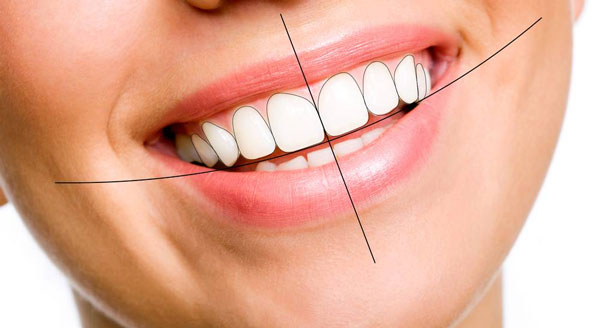 Niềng răng không chỉ mang lại nụ cười đẹp với hàm răng đều đặn mà còn có nhiều lợi ích tuyệt vời khác