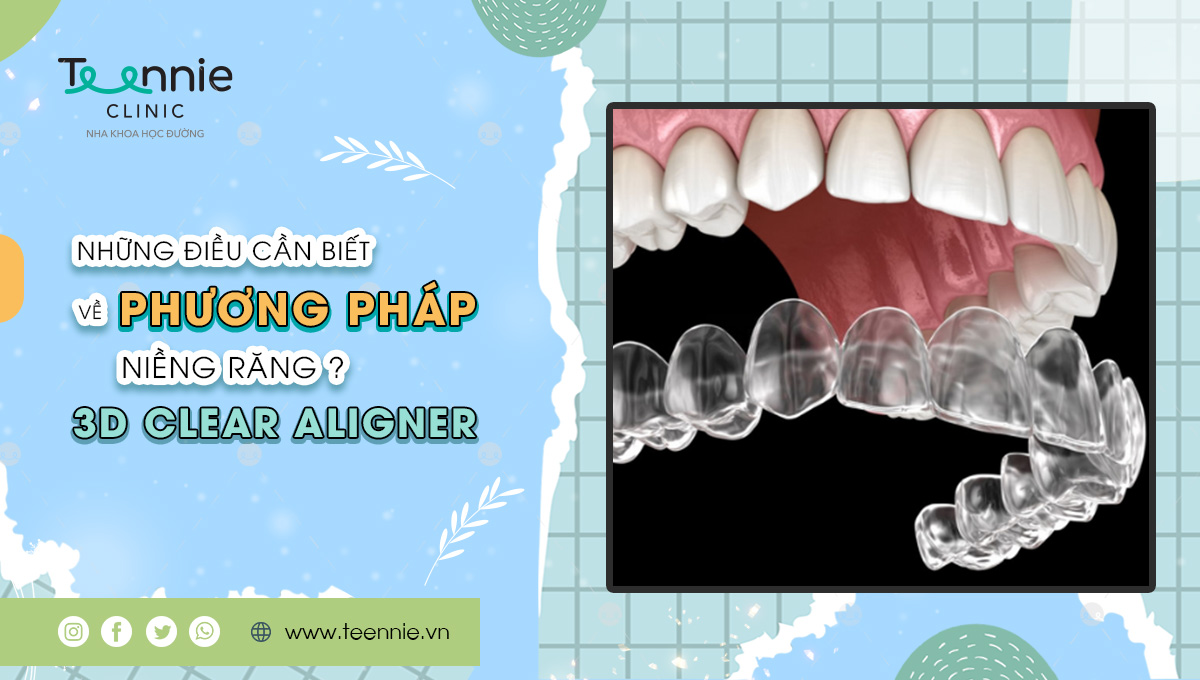 Niềng răng 3D Clear Aligner là gì? Có thực sự mang lại hiệu quả?