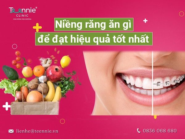 Cùng Teennie giải đáp thắc mắc niềng răng ăn gì, kiêng gì để sở hữu hàm răng đẹp