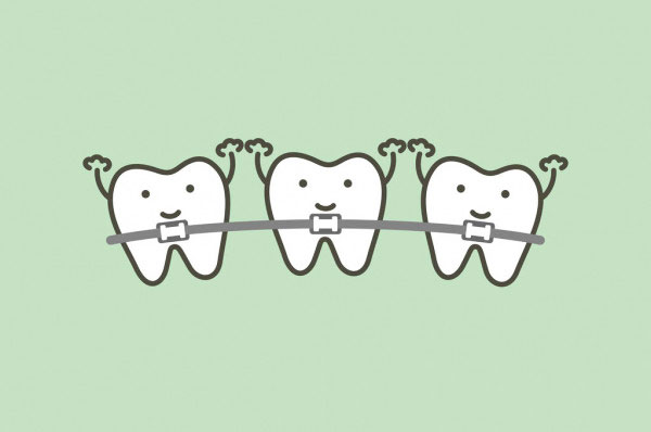 Chi phí niềng răng giá bao nhiêu cũng dựa trên tình trạng răng miệng