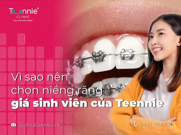 Niềng răng giá sinh viên – Nhiều chương trình hấp dẫn tại Teennie đang chào đón