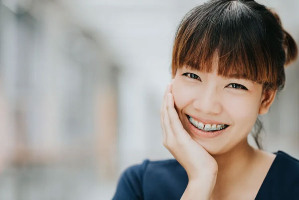Niềng răng được xem là giải pháp cải thiện răng thưa mang tính bền vững nhất