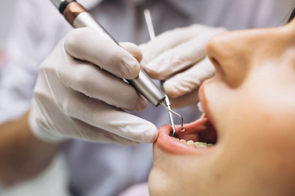 Cân nhắc trong việc lựa chọn nha khoa uy tín để niềng răng