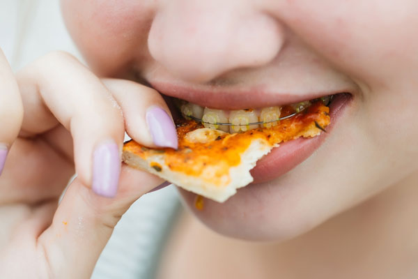 Trong quá trình niềng răng bạn không nên ăn thực phẩm quá dai, giòn, dính, cứng