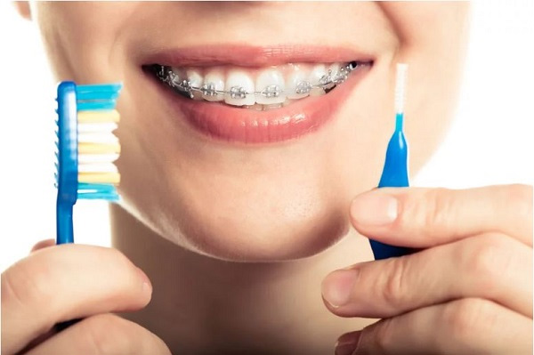 Cách vệ sinh răng miệng