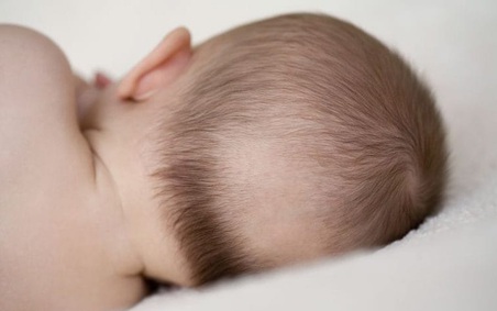 4 Kiểu Rụng Tóc Ở Trẻ Sơ Sinh Khiến Mẹ Lo Lắng
