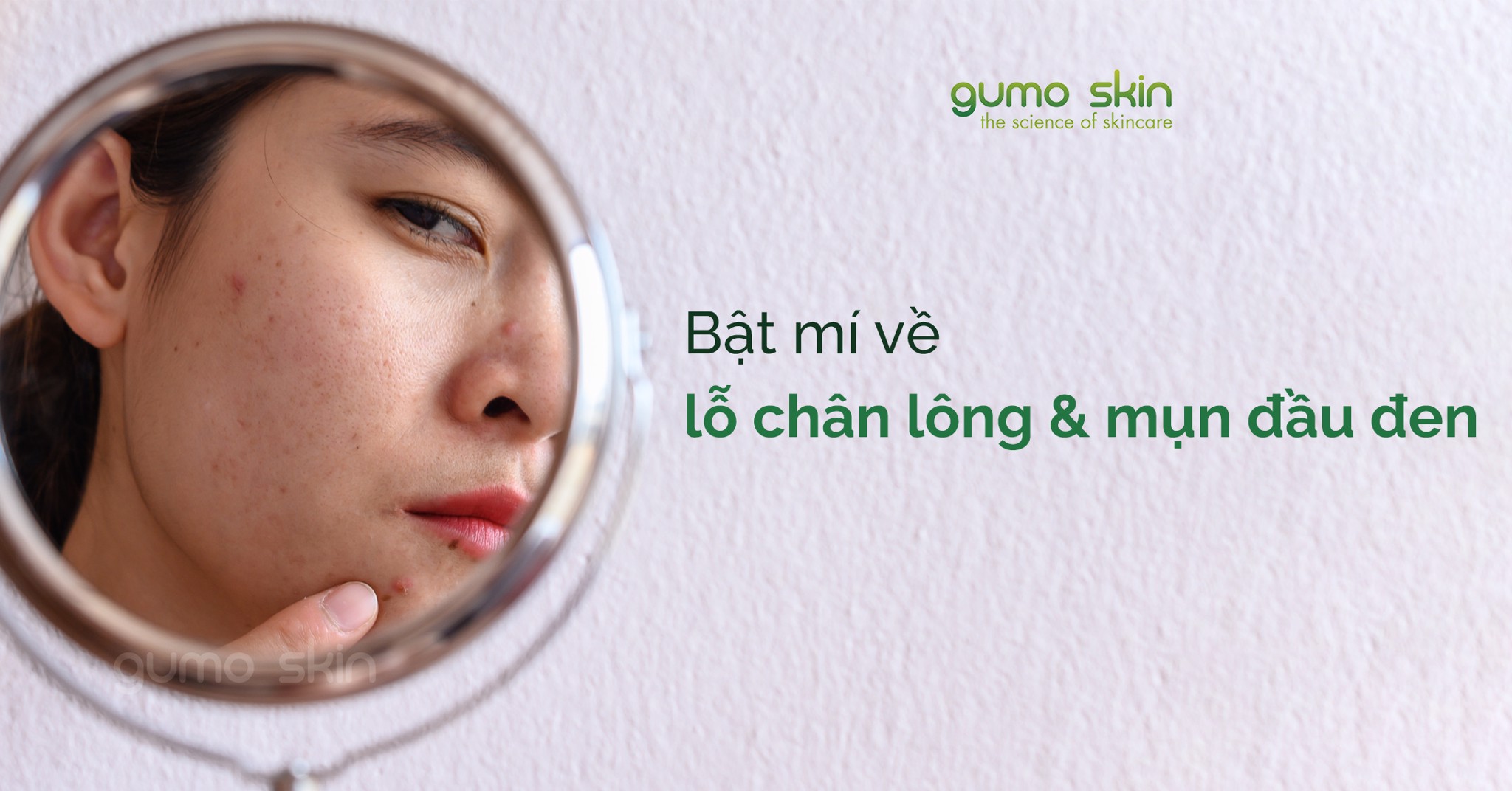 LỖ CHÂN LÔNG TO VÀ MỤN ĐẦU ĐEN – BẠN ĐÃ BIẾT? – GumoSkin