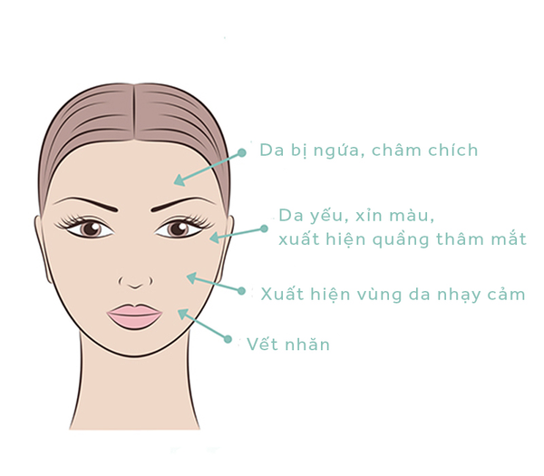 Dấu hiệu làn da mất cân bằng ẩm