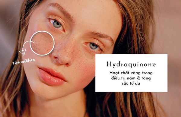 Hydroquinone là hoạt chất vàng trong điều trị nám và tăng sắc tố da