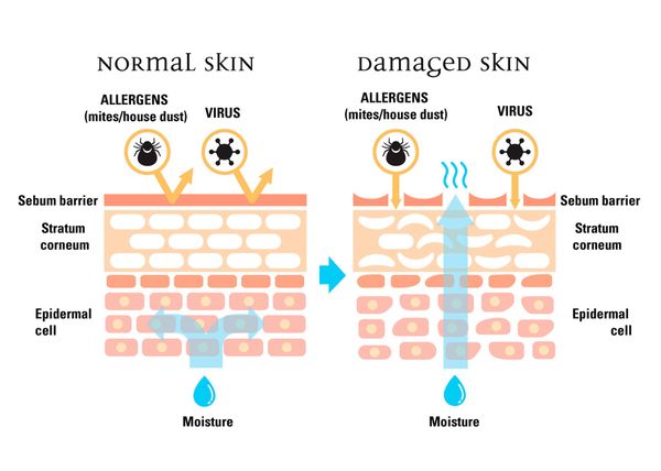 Niacinamide - Hàng rào bảo vệ làn da giúp duy trì độ mềm mại của làn da