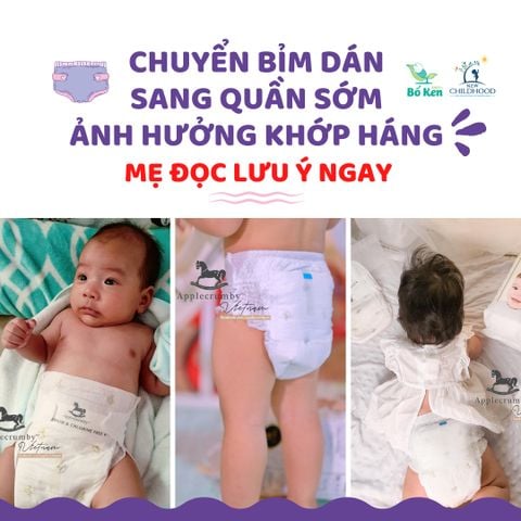 CHUYỂN SANG BỈM QUẦN SỚM NGUY CƠ ẢNH HƯỞNG KHỚP HÁNG CAO