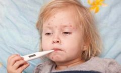 Các bệnh mùa hè thường gặp ở trẻ em cha mẹ cần lưu tâm