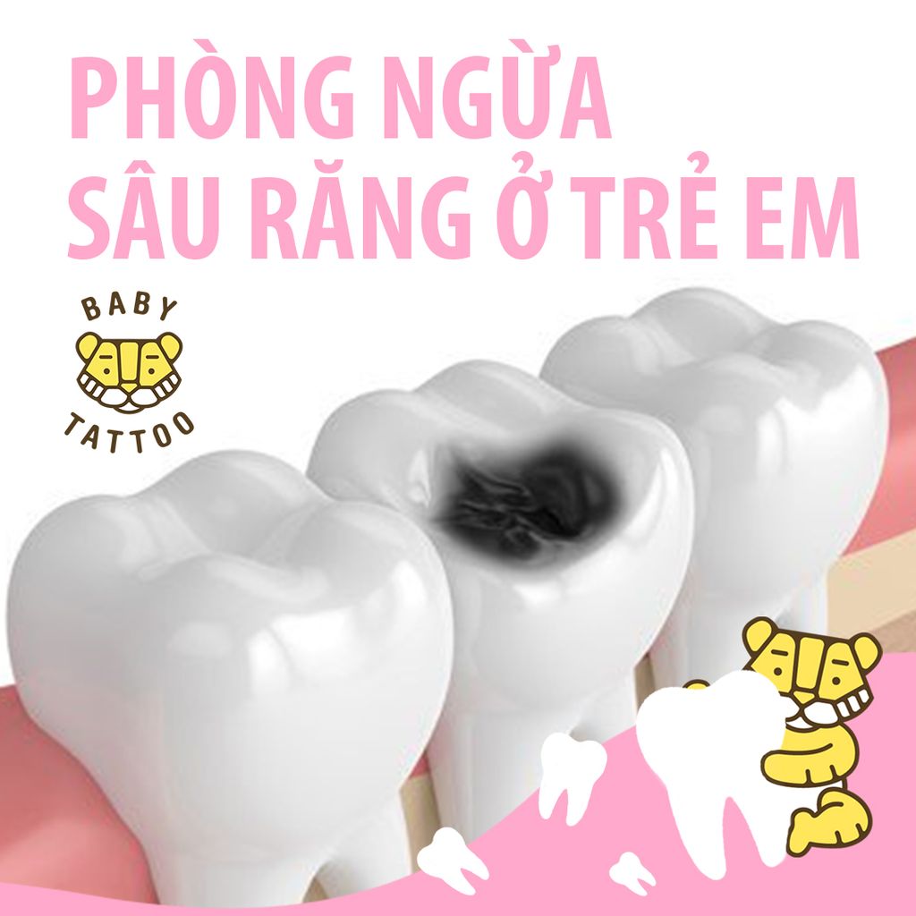 Phòng ngừa sâu răng cho trẻ em.