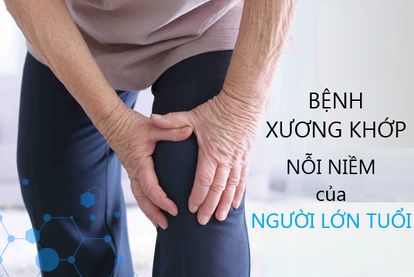 Những nguyên nhân cấu thành bệnh xương khớp