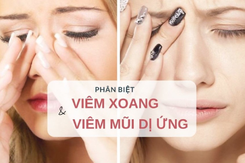 PHÂN BIỆT VIÊM XOANG VÀ VIÊM MŨI DỊ ỨNG