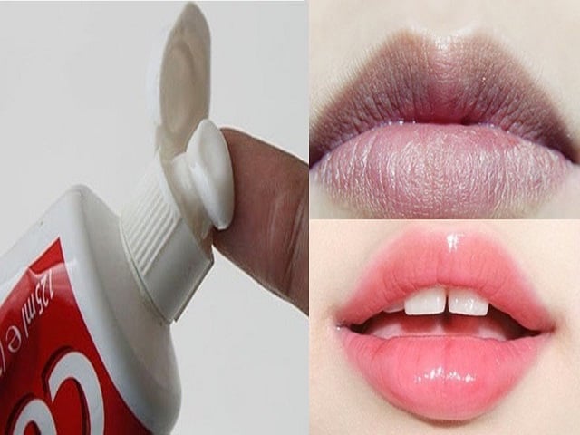 (Top) 8 cách trị thâm môi bằng kem đánh răng hiệu quả giúp môi hồng xinh