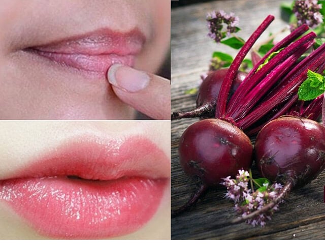 Bật mí 7 cách trị thâm môi bằng vitamin E khiến chị em mê tít