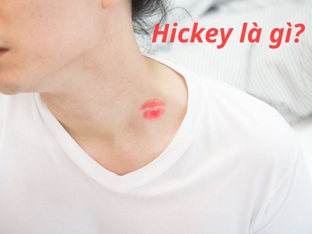 Hickey là gì? Cách tạo dấu Hickey đẹp, ấn tượng, an toàn nhất