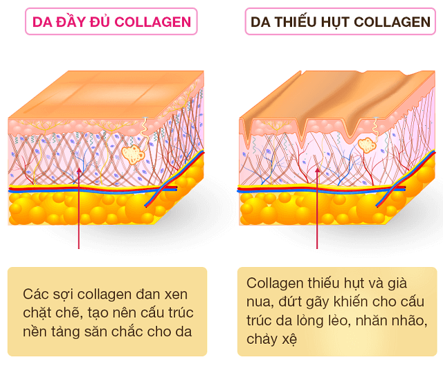 Collagen là loại protein có vai trò đặc biệt trong việc duy trì độ đàn hồi, trẻ trung của làn da