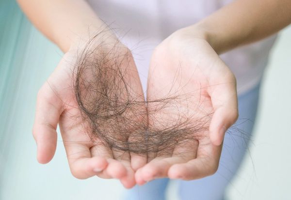 tóc rụng nhiều Top 3 cách trị rụng tóc hiệu quả cực nhanh áp dụng được  cho cả nam và nữ