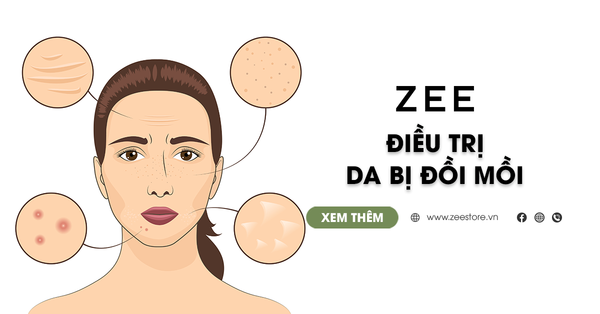 Tổng Hợp Bí Quyết Điều Trị Da Bị Đồi Mồi Cho Chị Em