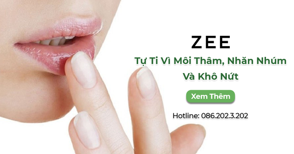 Tự Ti Vì Môi Thâm, Nhăn Nhúm Và Khô Nứt