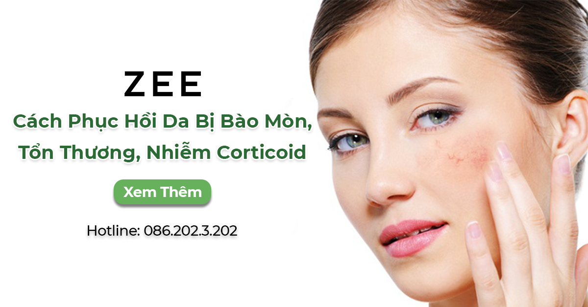 Cách Phục Hồi Da Bị Bào Mòn, Tổn Thương, Nhiễm Corticoid