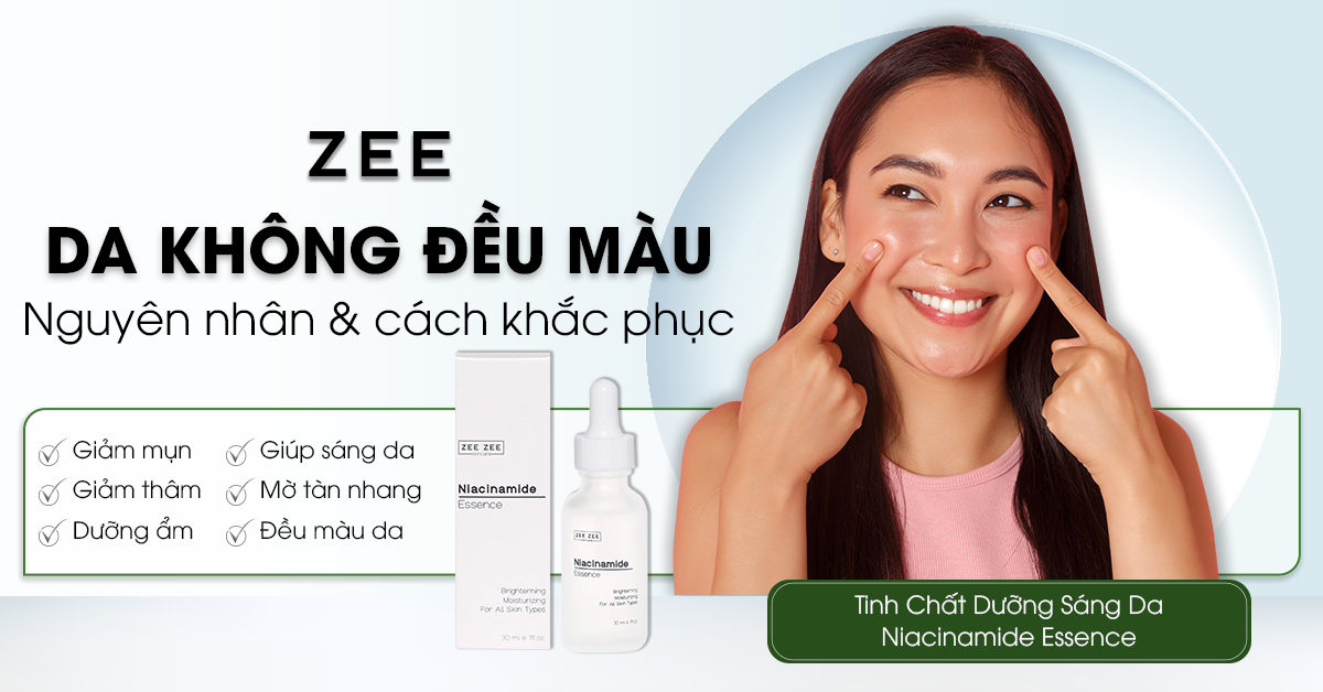 Da Không Đều Màu - Nguyên Nhân & Khắc Phục Dưỡng Sáng Da Hiệu Quả