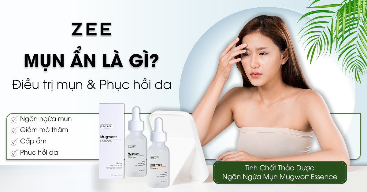 Mụn Ẩn Là Gì? Cách Điều Trị Mụn Và Phục Hồi Da