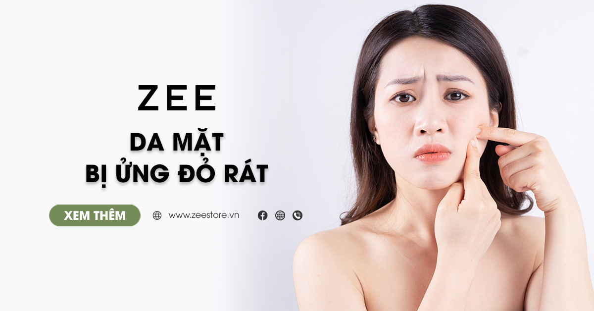 Da Mặt Bị Ửng Đỏ Rát - Nguyên Nhân Và Cách Khắc Phục