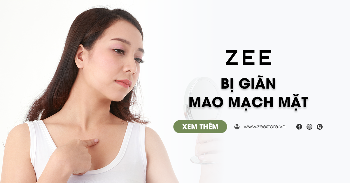 Bị Giãn Mao Mạch Mặt Có Trị Dứt Điểm Được Không?