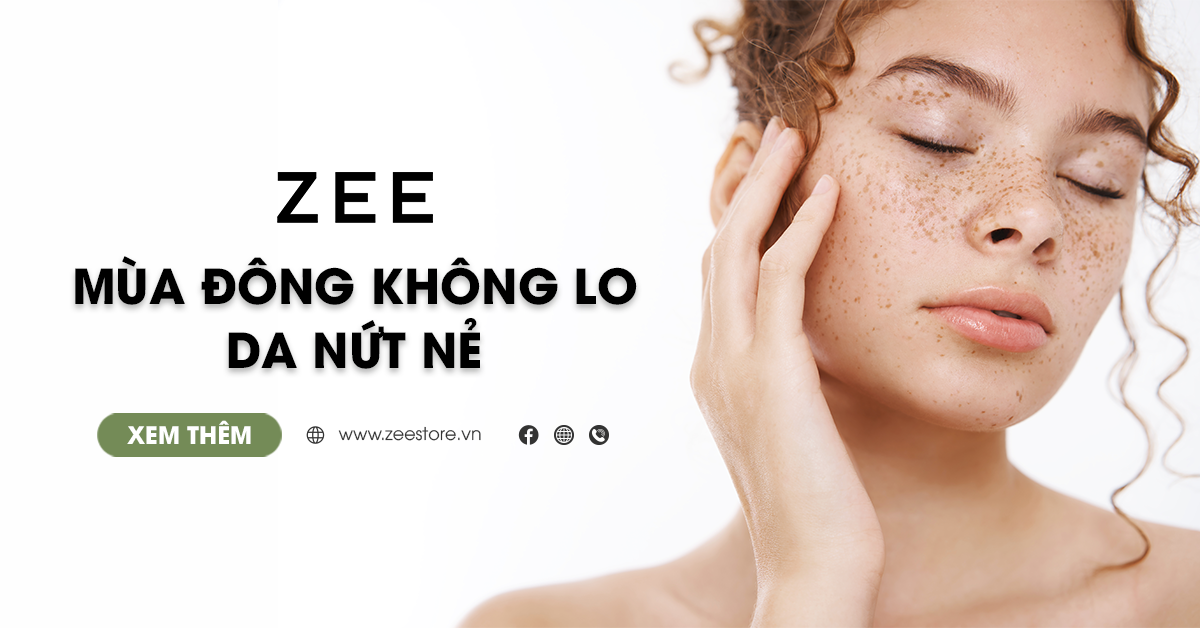 Mùa Đông Không Lo Da Nứt Nẻ Với 6 Gợi Ý Này