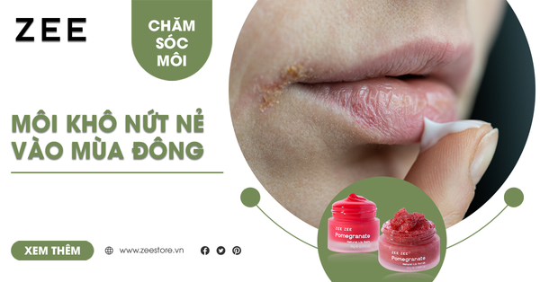 Tip Cứu Làn Môi Khô Nứt Nẻ Vào Mùa Đông Cực Hiệu Quả