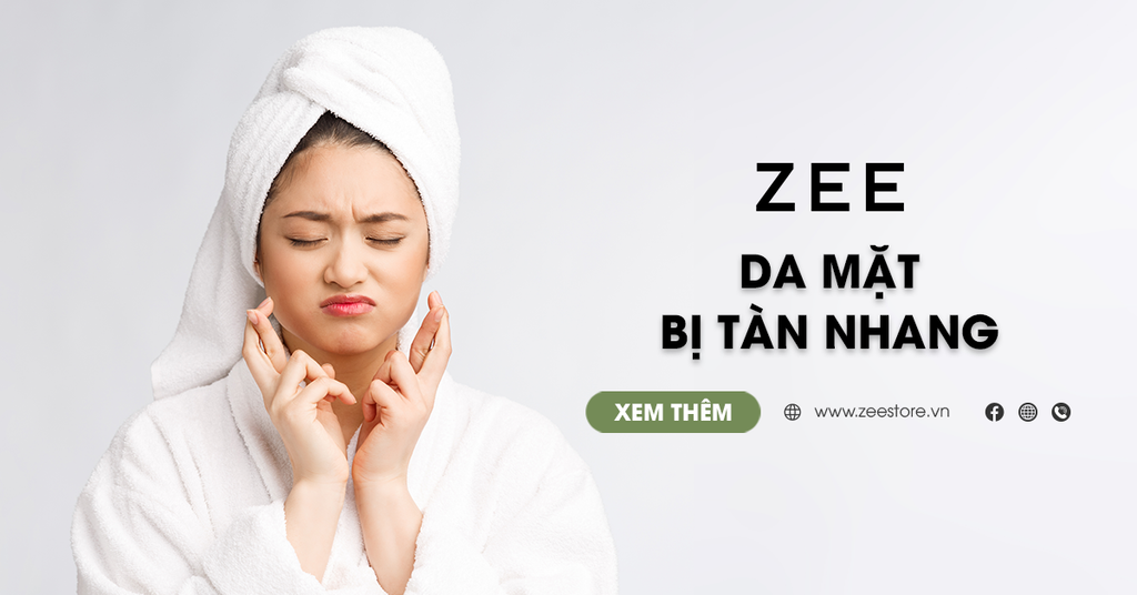 Da Mặt Bị Tàn Nhang - Nguyên Nhân Và 8+ Cách Loại Bỏ Hiệu Quả