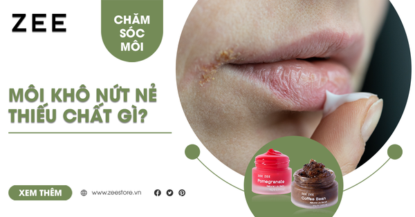 Môi Khô Nứt Nẻ Là Thiếu Chất Gì? Bệnh Gì? 5 Vitamin Cần Thiết Cho Môi