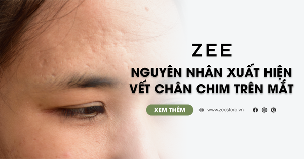 Mặt Rỗ Sau Mụn - Nguyên Nhân Và Cách Điều Trị Hiệu Quả
