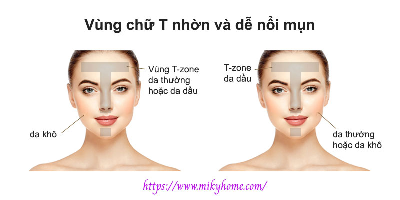 7 cách kiểm soát vùng chữ T nhờn và dễ nổi mụn – Miky's Home