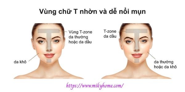 7 cách kiểm soát vùng chữ T nhờn và dễ nổi mụn