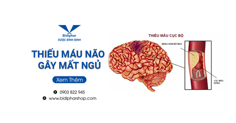 Thiếu Máu Não Gây Mất Ngủ: Nguyên Nhân Và Cách Điều Trị