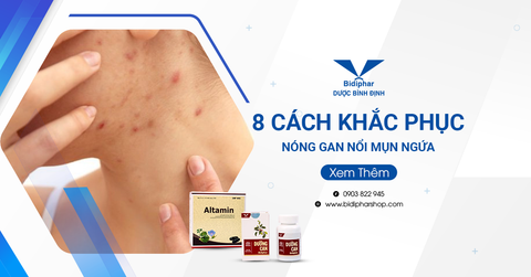 8 Cách Khắc Phục Nóng Gan Nổi Mụn Ngứa Hiệu Quả