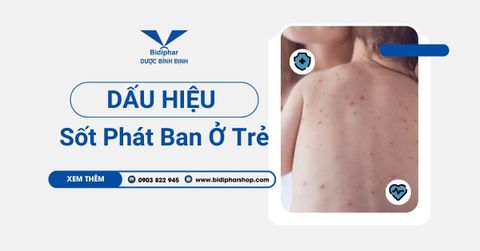 Dấu Hiệu Sốt Phát Ban Ở Trẻ: Cha Mẹ Phải Lưu Ý