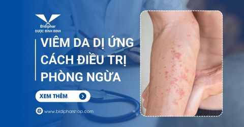 Viêm Da Dị Ứng Là Gì? Cách Điều Trị & Phòng Ngừa