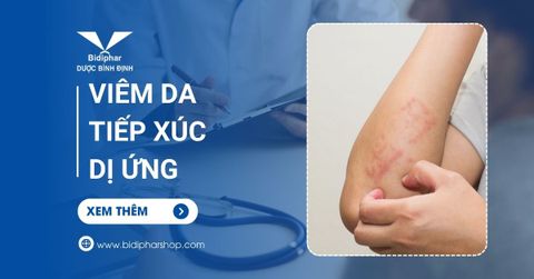 Viêm Da Tiếp Xúc Dị Ứng Là Bệnh Dễ Mắc Khó Chữa - Vì Sao?
