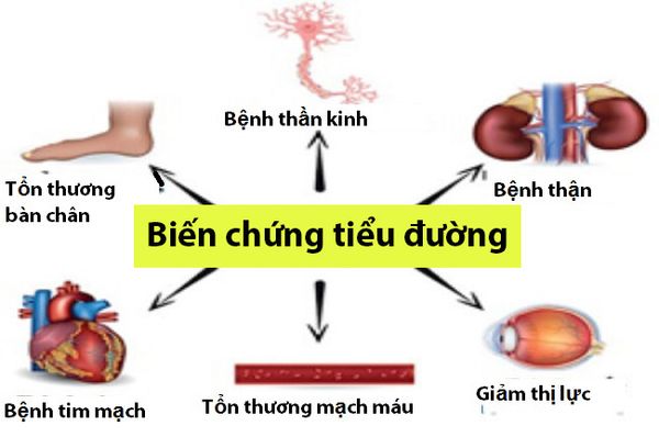 Các biến chứng tiểu đường tuýp 2