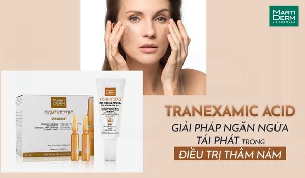 TRANEXAMIC ACID - GIẢI PHÁP NGĂN NGỪA TÁI PHÁT TRONG ĐIỀU TRỊ THÂM NÁM
